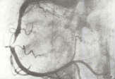 Listen to a cardiologist while there's still time to take his message to heart