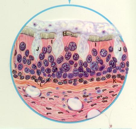 damaged cilia