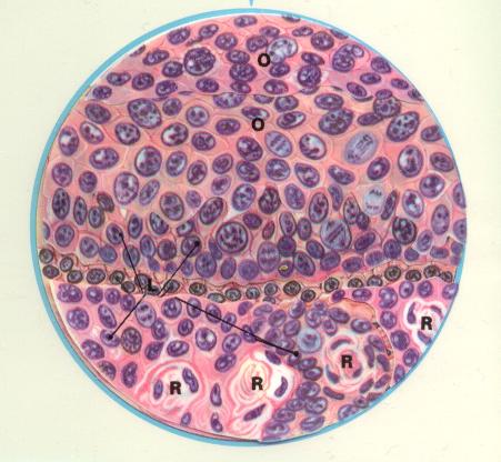 smoking effects on lungs. Joel#39;s Library - Smoking#39;s