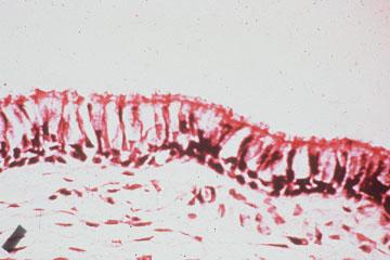 normal cilia