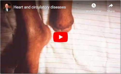 Video cover screenshot for Joel Spitzer's heart and circulatory diseases video