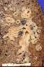 This lung photo shows oat cell cancer (also known as small cell) which occurs almost exclusively in smokers.