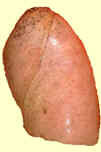 Why smokers lungs don�t look like this, By Joel Spitzer