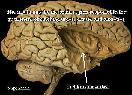 Human brain showing right insula cortex