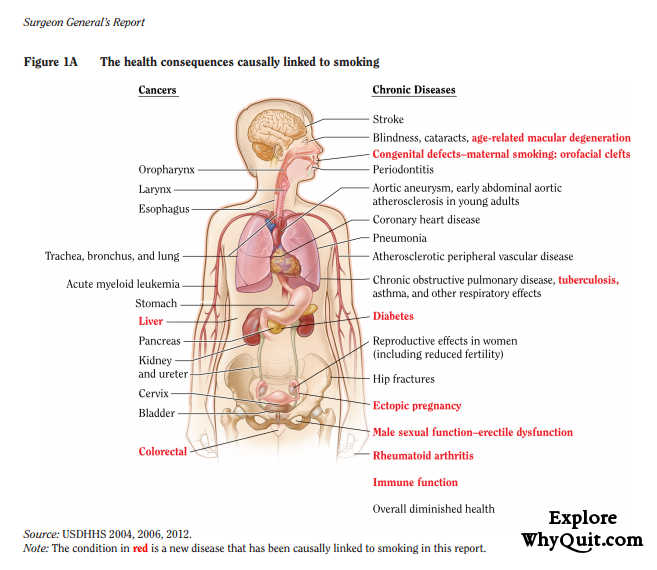 Figure 1.1A of the 2014 US Surgeon General's Report shows a picture of the internal human body pointing out the cancers and chronic diseases caused by cigarette smoking