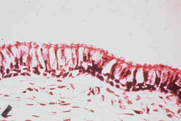 بافت واقعی ریه در زیر میکروسکوپ