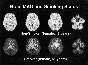 Brain scan showing MAO of smoker vs non-smoker
