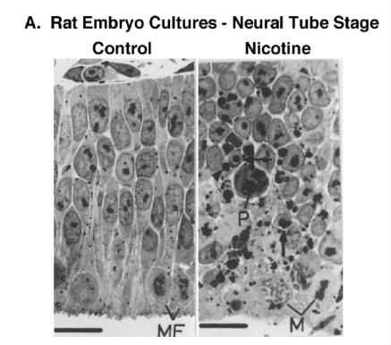 A slide of cellular damage inflicted by nicotine in the neural tube stage in rats when compared to normal development, from a study by Slotkin published in the Jan-Feb 2008 issue of Neurotoxicology and Teratology