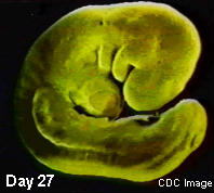 This CDC neural tube stage image shows the embryo at day 27, with the developing brain, spine and arm clearly visible