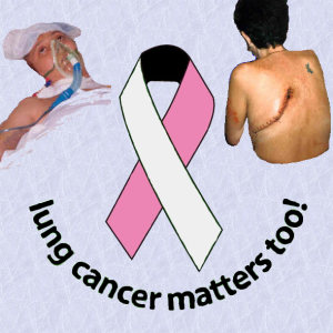 Lung Cancer Matters Too!