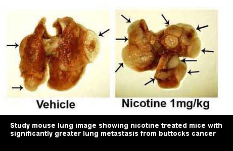 Study imagine showing nicotine treated mice with significantly more lung metastasis from primary Line1 s.c. tumors.