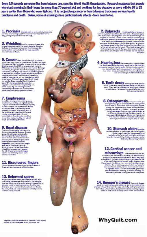 A chart showing the smoker's body and the damage smoking inflicts upon various body parts and organs.